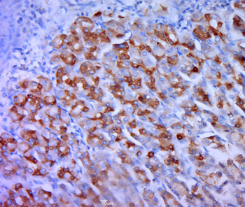 Phospho-Bcl2 (Thr69) Rabbit Polyclonal Antibody