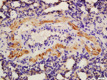 Phospho-Bcl2 (Thr69) Rabbit Polyclonal Antibody