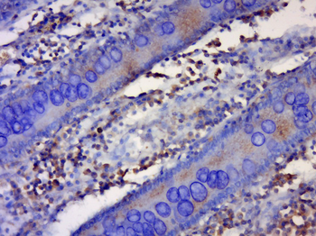 Phospho-Bcl-xL (Thr47) Rabbit Polyclonal Antibody