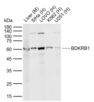 BDKRB1 Rabbit Polyclonal Antibody