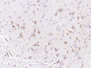BDNF Rabbit Polyclonal Antibody
