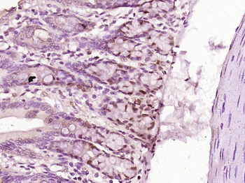 Phospho-beta Catenin (Ser37) Rabbit Polyclonal Antibody