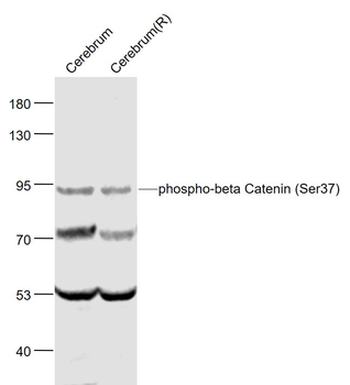 Phospho-beta Catenin (Ser37) Rabbit Polyclonal Antibody