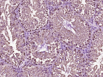 Phospho-beta Catenin (Tyr333) Rabbit Polyclonal Antibody