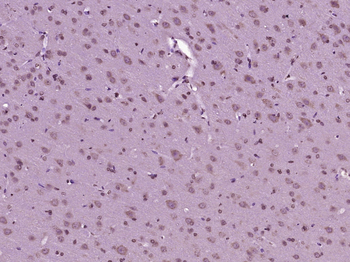 Phospho-beta Catenin (Tyr333) Rabbit Polyclonal Antibody