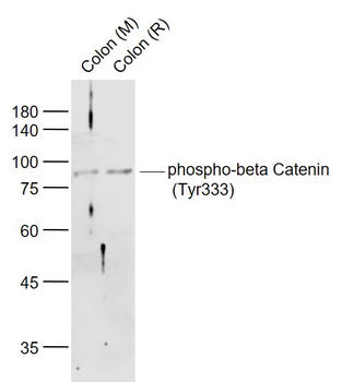 Phospho-beta Catenin (Tyr333) Rabbit Polyclonal Antibody