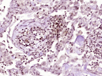 Phospho-beta Catenin (Tyr489) Rabbit Polyclonal Antibody