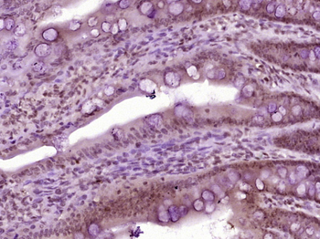 Phospho-beta Catenin (Tyr489) Rabbit Polyclonal Antibody