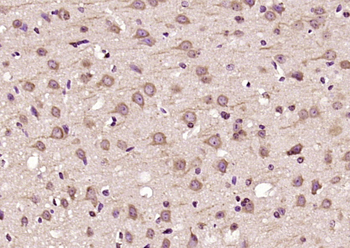 BLMH Rabbit Polyclonal Antibody