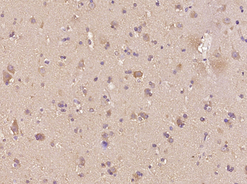 Phospho-BNIP3 (Ser95) Rabbit Polyclonal Antibody