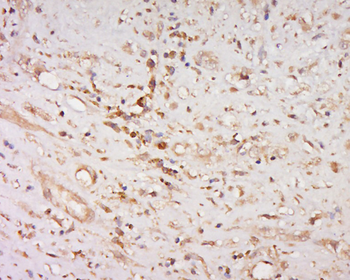 Phospho-BNIP3 (Ser95) Rabbit Polyclonal Antibody