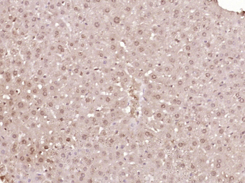 BOP1 Rabbit Polyclonal Antibody