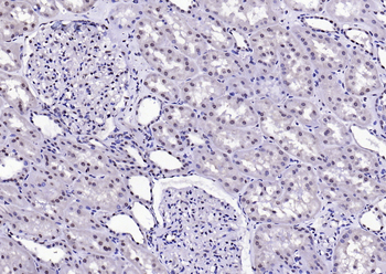 BPTF Rabbit Polyclonal Antibody