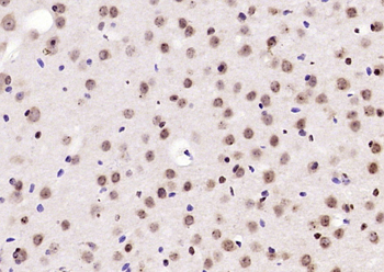 BPTF Rabbit Polyclonal Antibody
