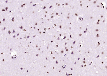 BPTF Rabbit Polyclonal Antibody