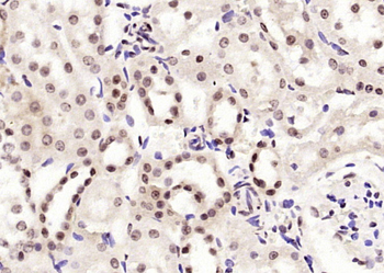 BPTF Rabbit Polyclonal Antibody