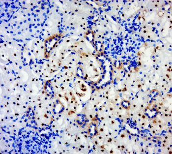 BPTF Rabbit Polyclonal Antibody