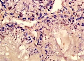 BPTF Rabbit Polyclonal Antibody