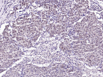 Phospho-BRAF (Ser729) Rabbit Polyclonal Antibody
