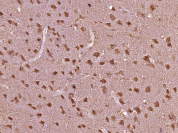 Phospho-BRAF (Ser729) Rabbit Polyclonal Antibody