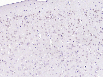Phospho-BRAF (Ser729) Rabbit Polyclonal Antibody