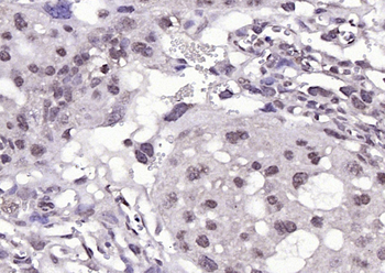 Phospho-BRAF (Ser729) Rabbit Polyclonal Antibody