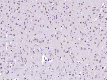 Phospho-BRAF (Ser729) Rabbit Polyclonal Antibody