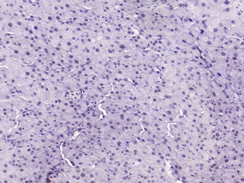 Phospho-BRAF (Ser729) Rabbit Polyclonal Antibody