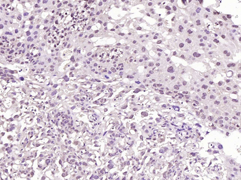 Phospho-BRAF (Ser729) Rabbit Polyclonal Antibody