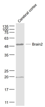 Brain2 Rabbit Polyclonal Antibody