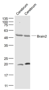 Brain2 Rabbit Polyclonal Antibody