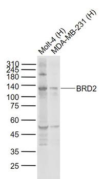 BRD2 Rabbit Polyclonal Antibody
