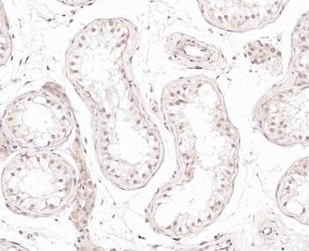 BRMS1 Rabbit Polyclonal Antibody