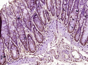 BRMS1 Rabbit Polyclonal Antibody