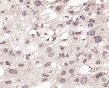 BRMS1 Rabbit Polyclonal Antibody