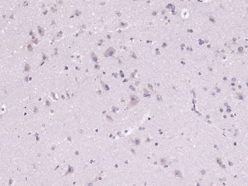 C1orf156 Rabbit Polyclonal Antibody