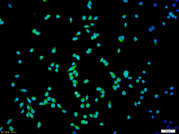FAK Rabbit Polyclonal Antibody (FITC)