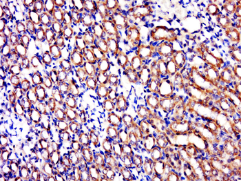 C1orf69 Rabbit Polyclonal Antibody