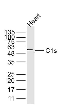C1s Rabbit Polyclonal Antibody