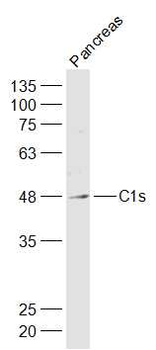 C1s Rabbit Polyclonal Antibody