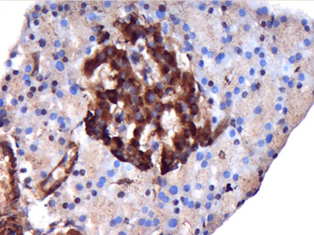 MAP3K7CL Rabbit Polyclonal Antibody