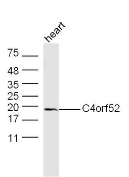 C4orf52 Rabbit Polyclonal Antibody