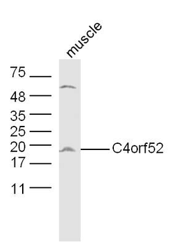 C4orf52 Rabbit Polyclonal Antibody