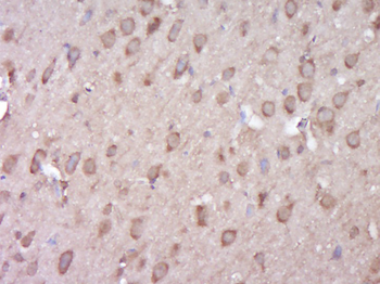 C6ORF199 Rabbit Polyclonal Antibody