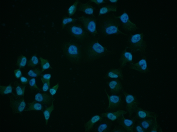 Phospho-c-Abl (Ser569) Rabbit Polyclonal Antibody