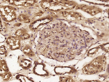 Phospho-c-Abl (Ser569) Rabbit Polyclonal Antibody