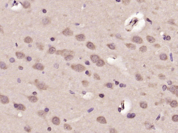 Phospho-c-ABL (Tyr115) Rabbit Polyclonal Antibody