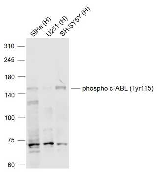 Phospho-c-ABL (Tyr115) Rabbit Polyclonal Antibody