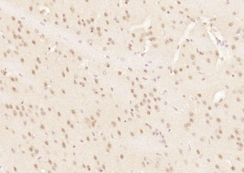 Phospho-c-ABL (Tyr204) Rabbit Polyclonal Antibody