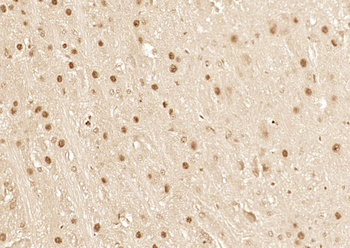 Phospho-c-ABL (Tyr204) Rabbit Polyclonal Antibody